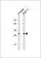 OR4M2 Antibody (C-term)
